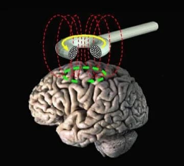 Illustration of a figure-eight TMS coil held above a human brain, with red dashed lines showing the magnetic field passing into the brain and a green loop showing the electrical current it induces in the cortex