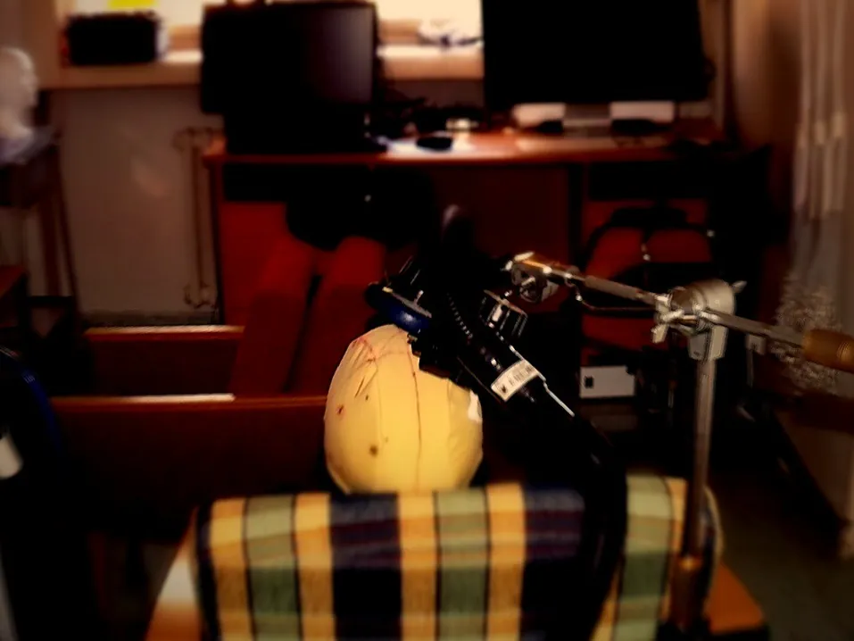 A TMS treatment coil on an adjustable arm, resting against a head covered by a yellow fitted cap with measurement marks, in a dim research room with two computer screens behind it